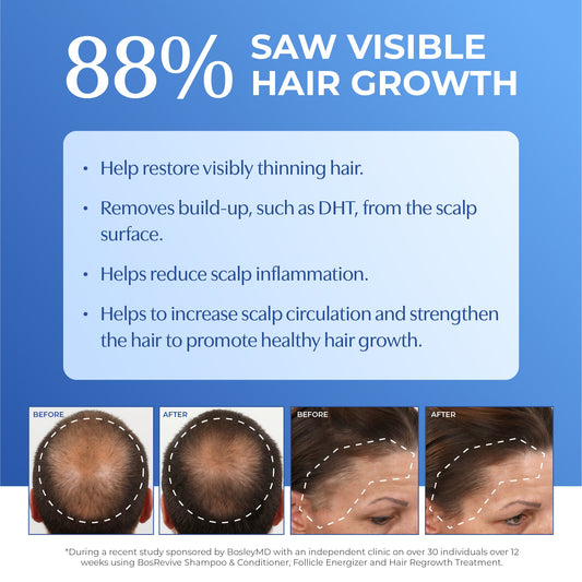 BosleyMD BosRevive Non Color-Treated 30 Day Kit – current formula image