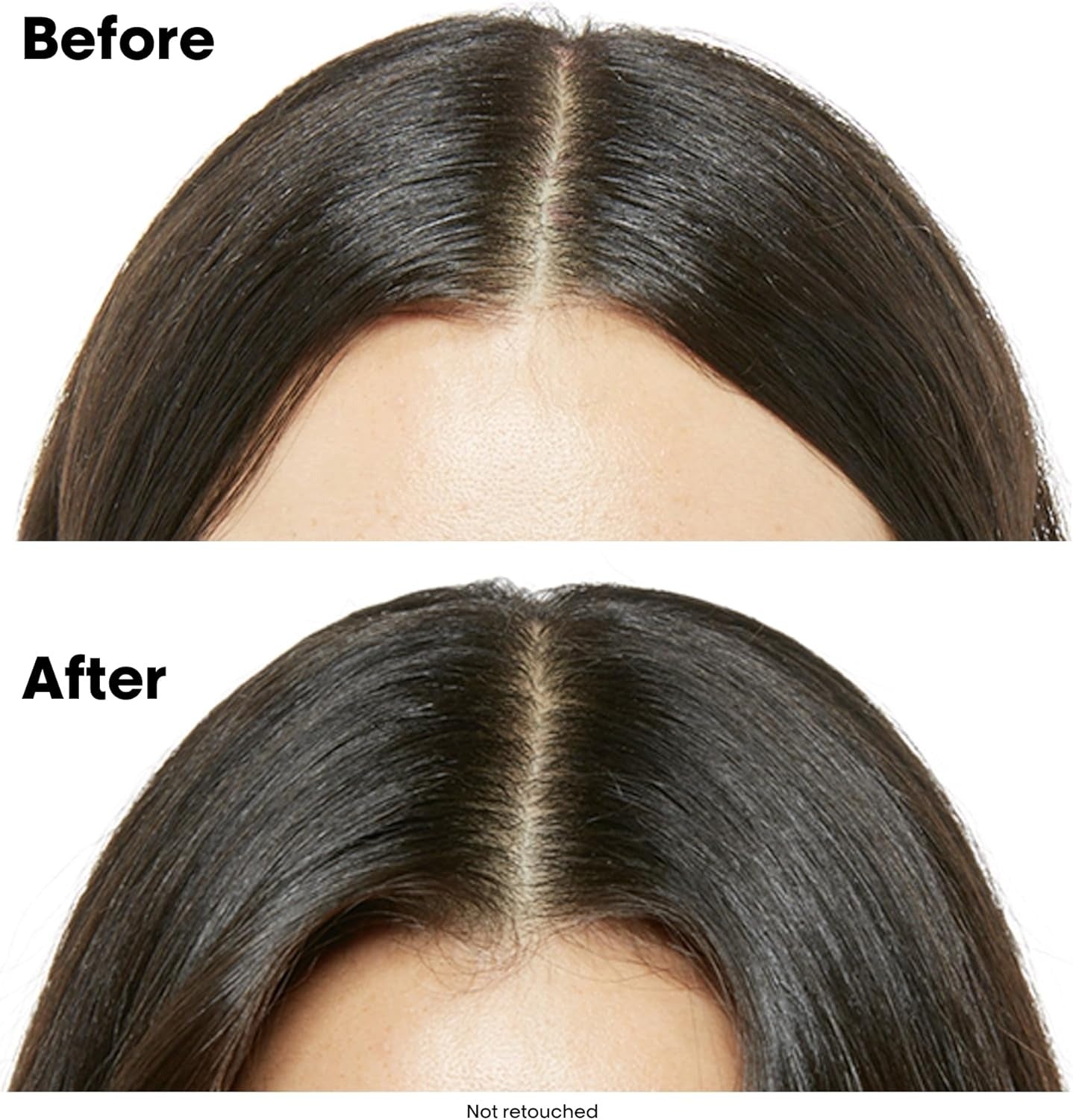 L'Oréal Professionnel Scalp Advanced Anti-Discomfort Shampoo for Sensitive Scalps