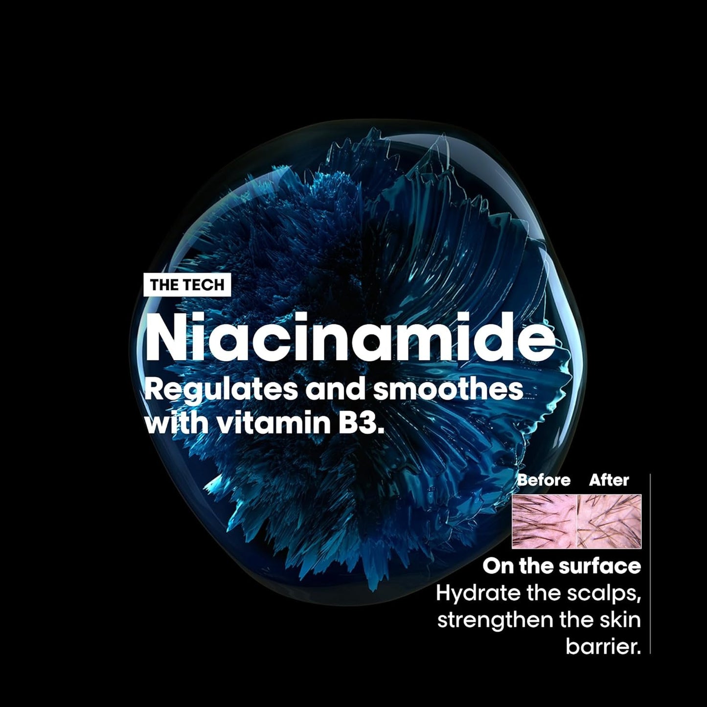 L'Oréal Professionnel Scalp Advanced Anti-Discomfort Shampoo for Sensitive Scalps