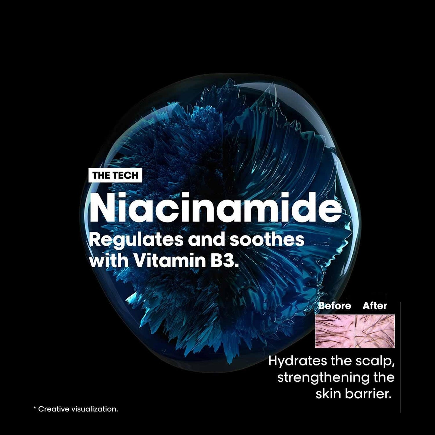 L'Oréal Professionnel Scalp Advanced Anti-Discomfort Intense Soothing Treatment – 200ml