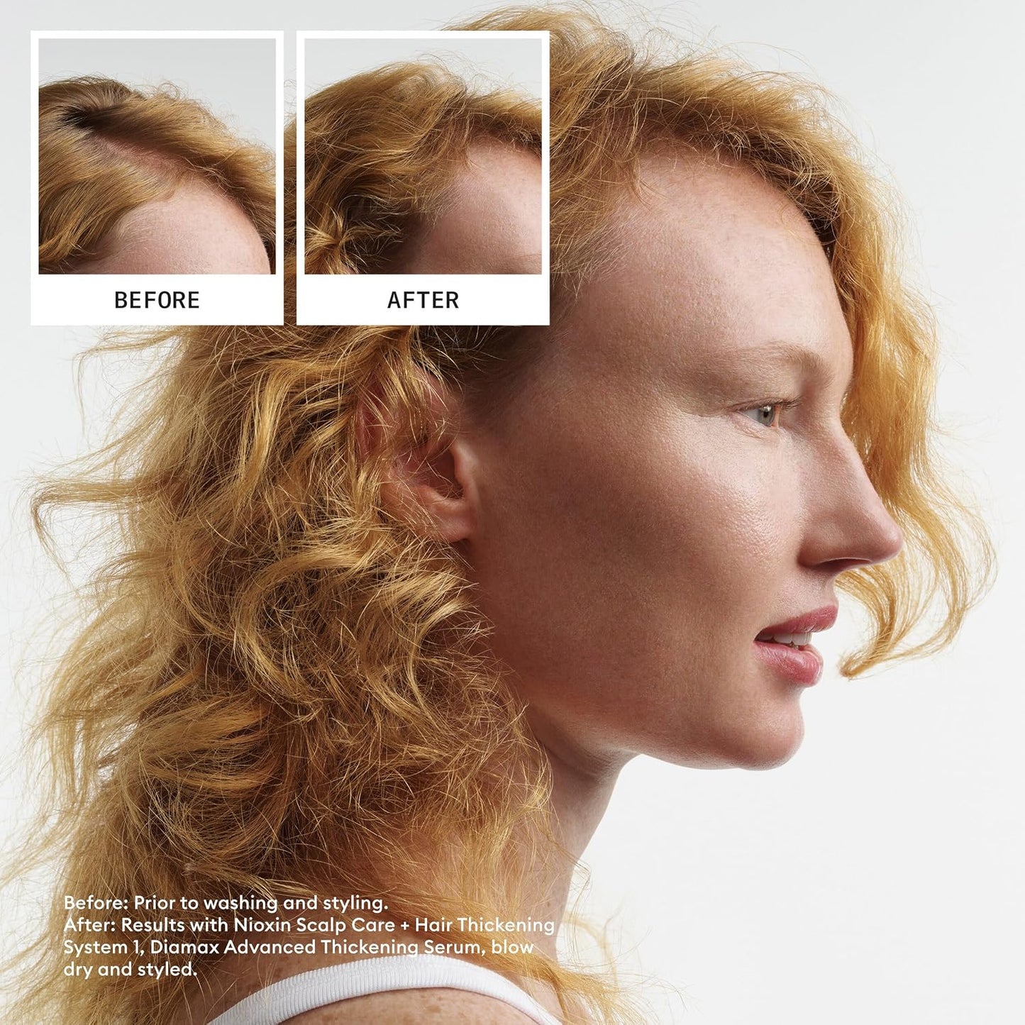 Nioxin System 4 Cleanser Shampoo