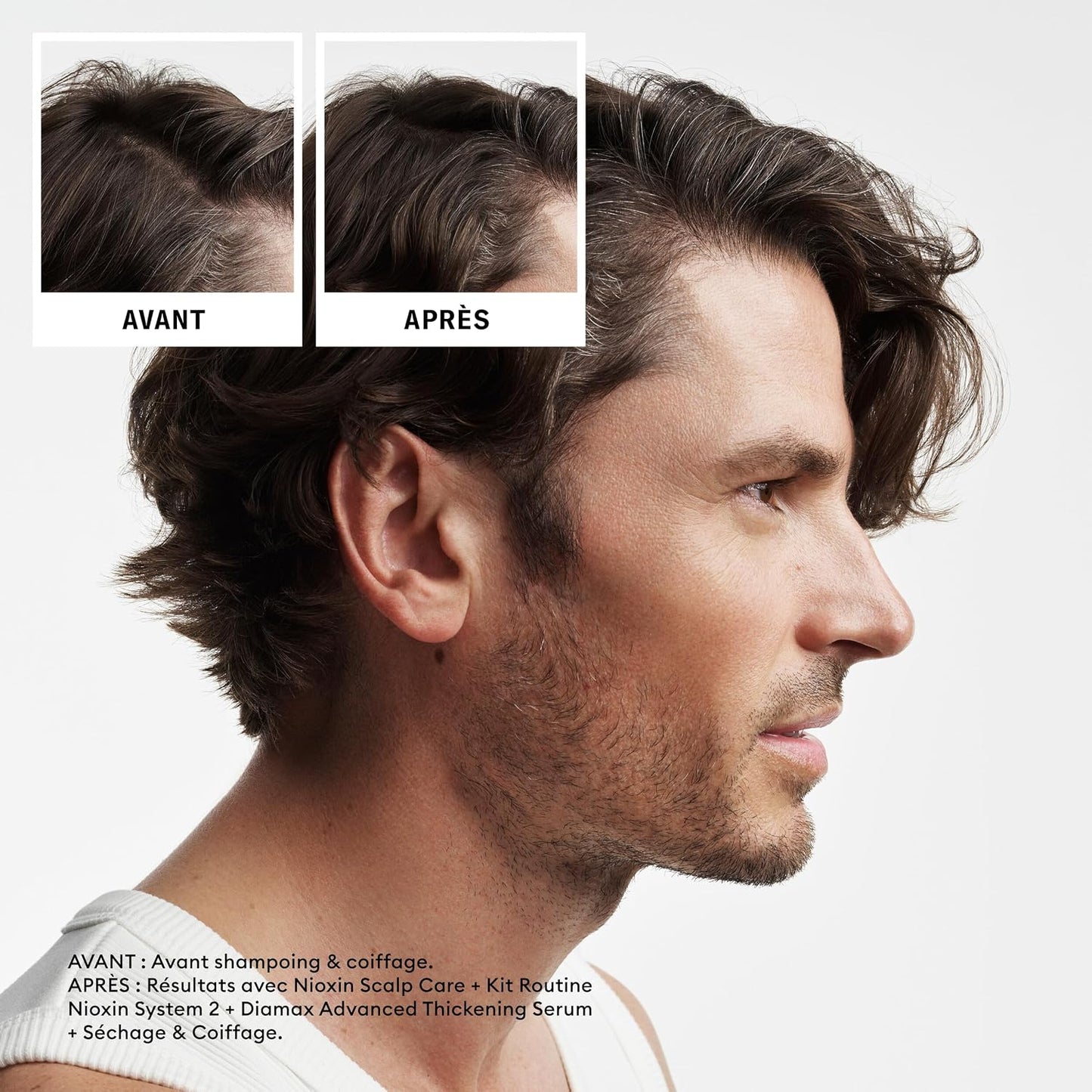 Nioxin System 2 Cleanser Shampoo