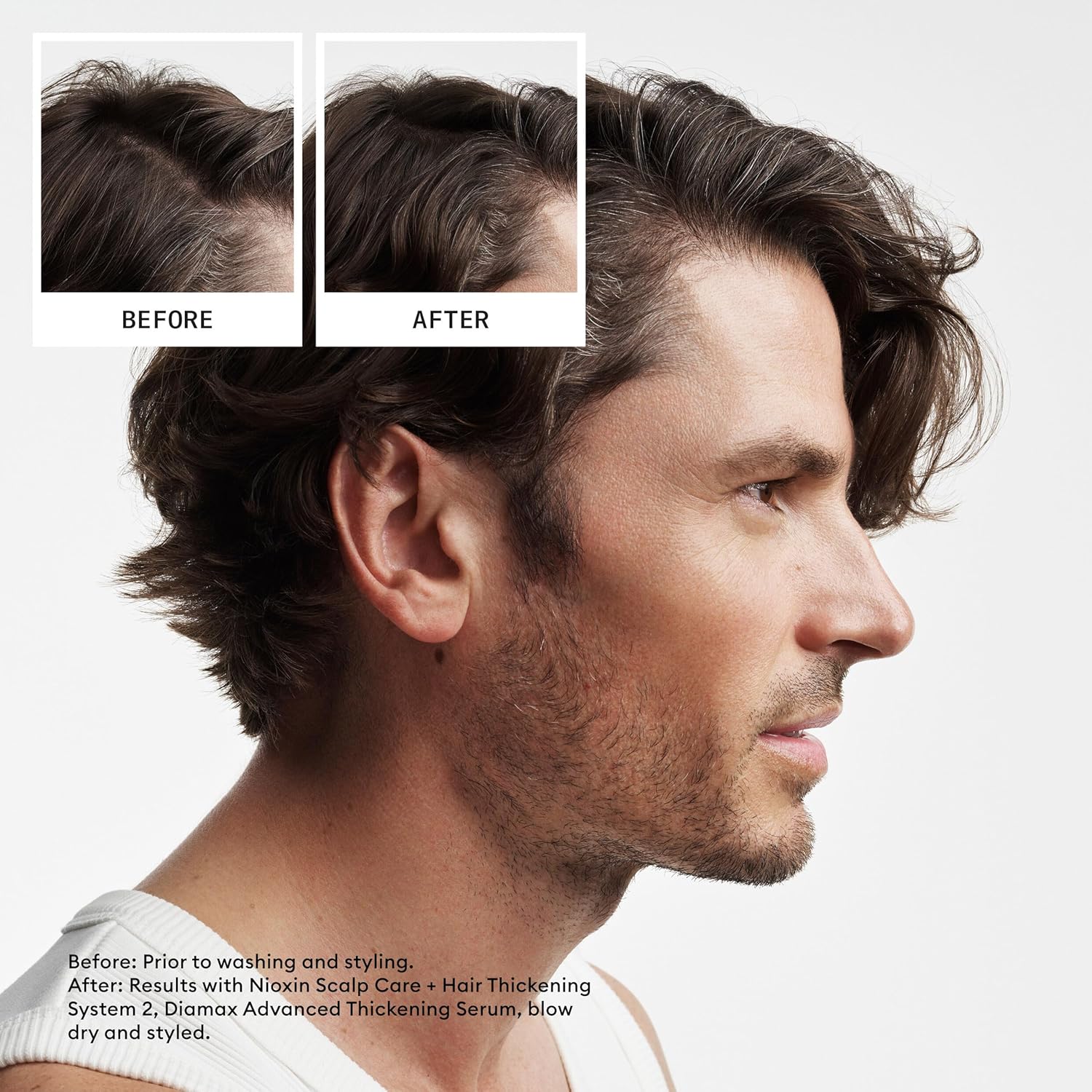 Nioxin System 2 Scalp Therapy Revitalising Conditioner