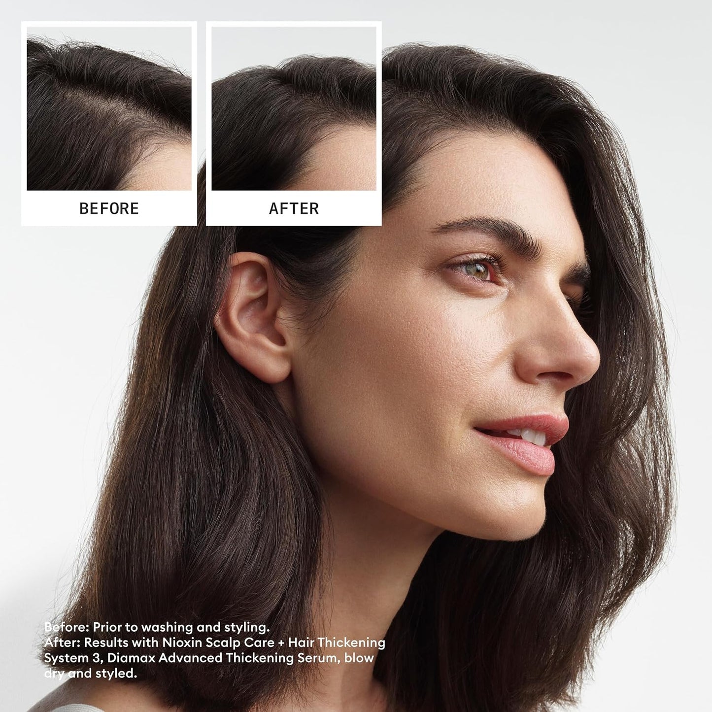 Nioxin System 3 Cleanser Shampoo