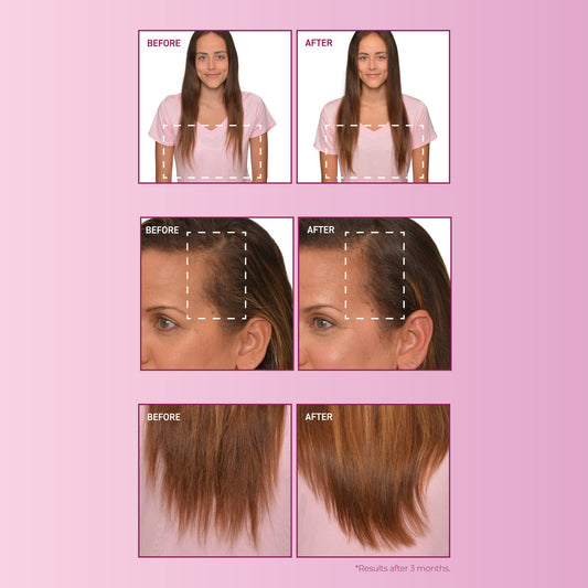 BosleyMD mendXtend Strengthening System – current formula image