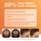 BosleyMD BosRevive Color Safe 30 Day Kit – current formula image