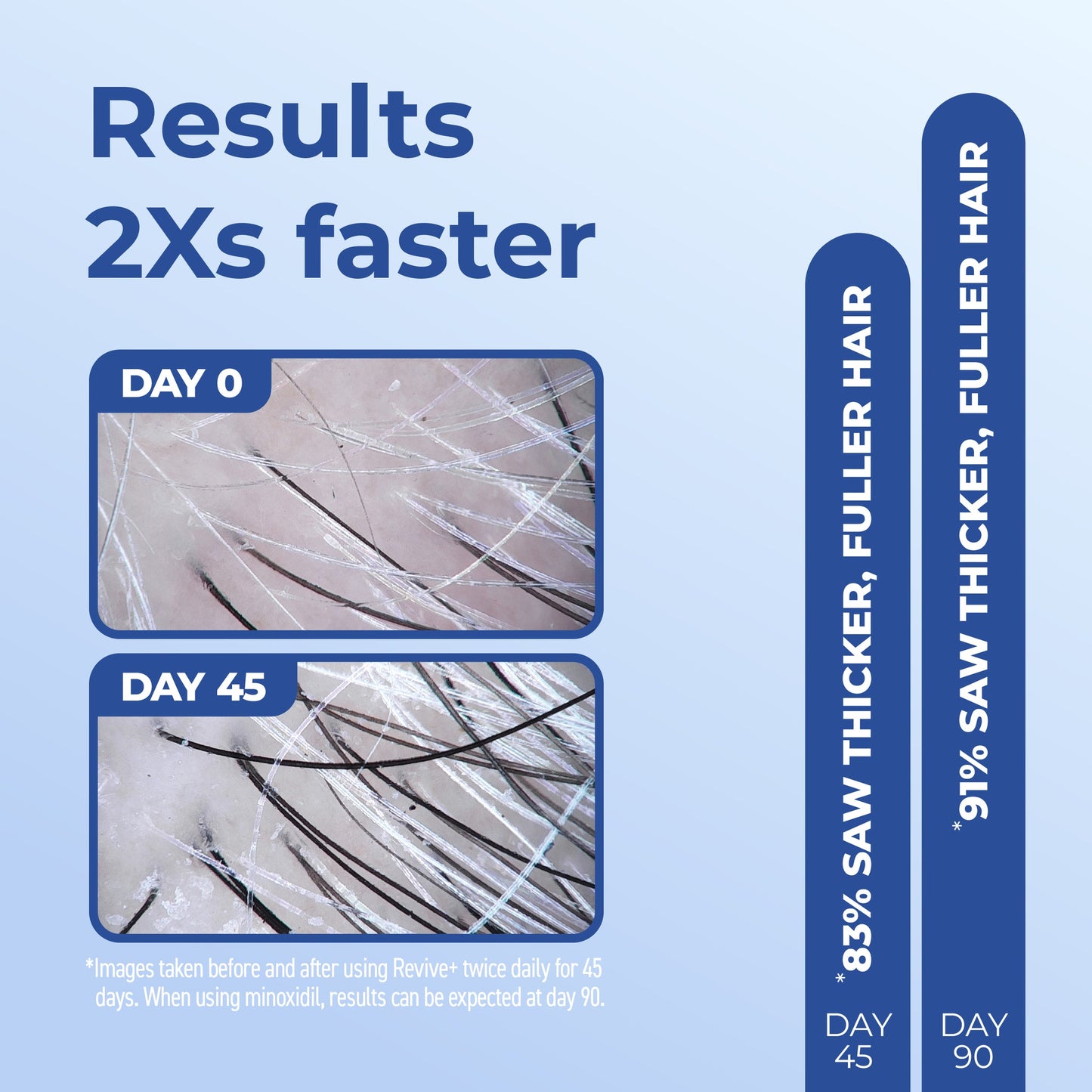 BosleyMD Men's Revive+ Densifying Treatment Foam – current results image