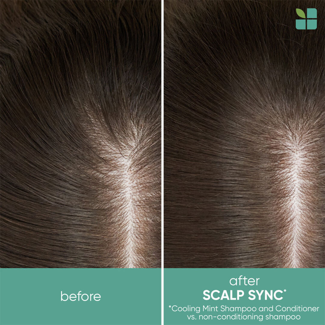 Biolage ScalpSync Cool Mint Shampoo — scalp before and after, excess oil removed